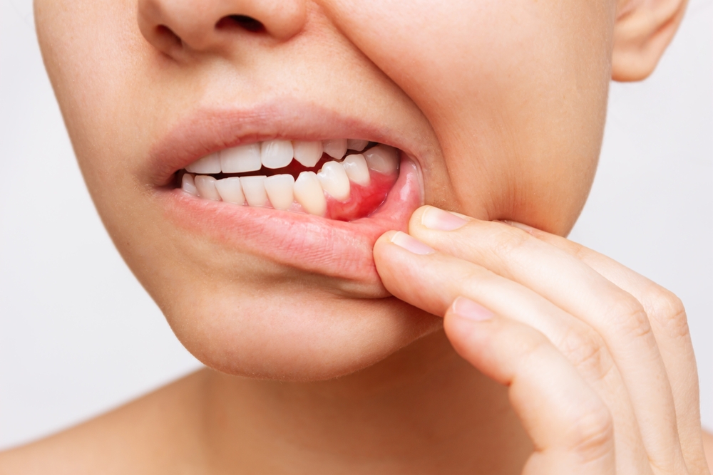 Top Oral Health Tips to Prevent Gum Disease | Vienna Clinic